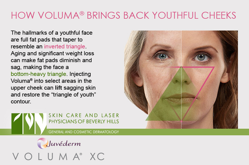 Our dermatologists in Beverly Hills inject Voluma to the upper cheeks to enhance youthful contours.