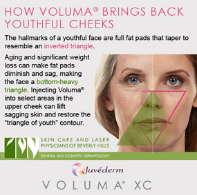 Our dermatologists in Beverly Hills inject Voluma to the upper cheeks to enhance youthful contours.