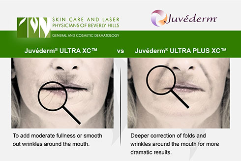 Discover what ULTRA XC and ULTRA Plus XC have in common and what sets them apart in the Juvéderm family at the Los Angeles area's Skin Care and Laser Center of Beverly Hills.